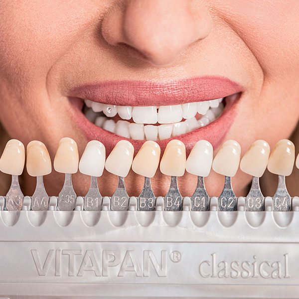 Dachau-Zahnarzt-Dr.-Gitt---Zahnaesthetik Nahaufnahme eines Mundes mit schönen Zähnen und Zahnschmuck.