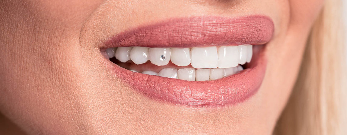 Guided Biofilm Therapy 2 Lächelnder Mund mit professionell gereinigten Zähnen .