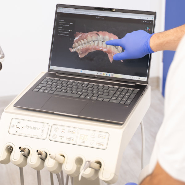 Zahnarztpraxis Dachau - neue Geraete 2 Bild einer Abformung, die mit dem Intraoralscanner in der Zahnarztpraxis Dachau erstellt wurde.