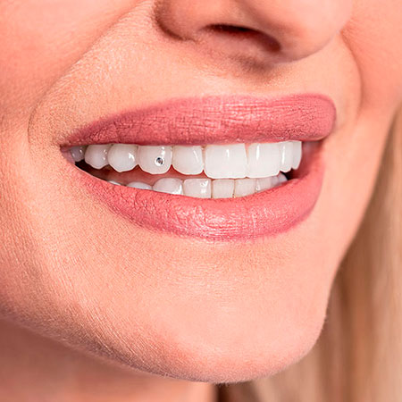 professionelle-Zahnreinigung Lächelnder Mund dank professionelle-Zahnreinigung.