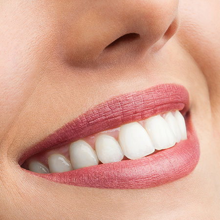 professionelle-Zahnreinigung-Dachau Schöner Mund mit strahlenden Zähnen durch die professionelle-Zahnreinigung-Dachau.